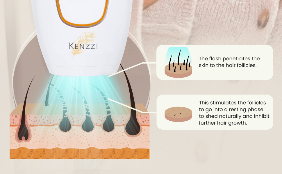 Kenzzi IPL Appareil d’épilation Laser "Authentique"