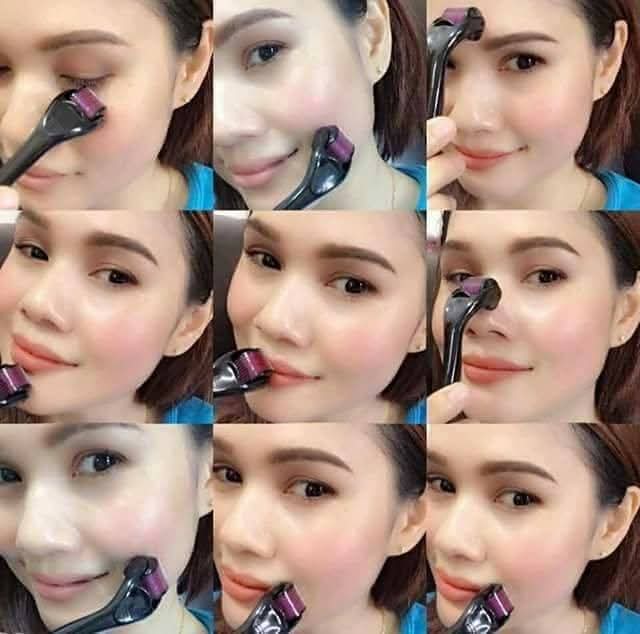 Derma roller